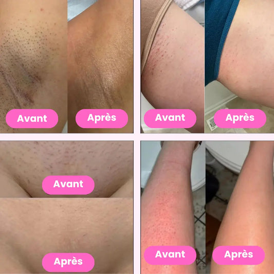 Lady Shaver • Épilateur Électrique Nusikana